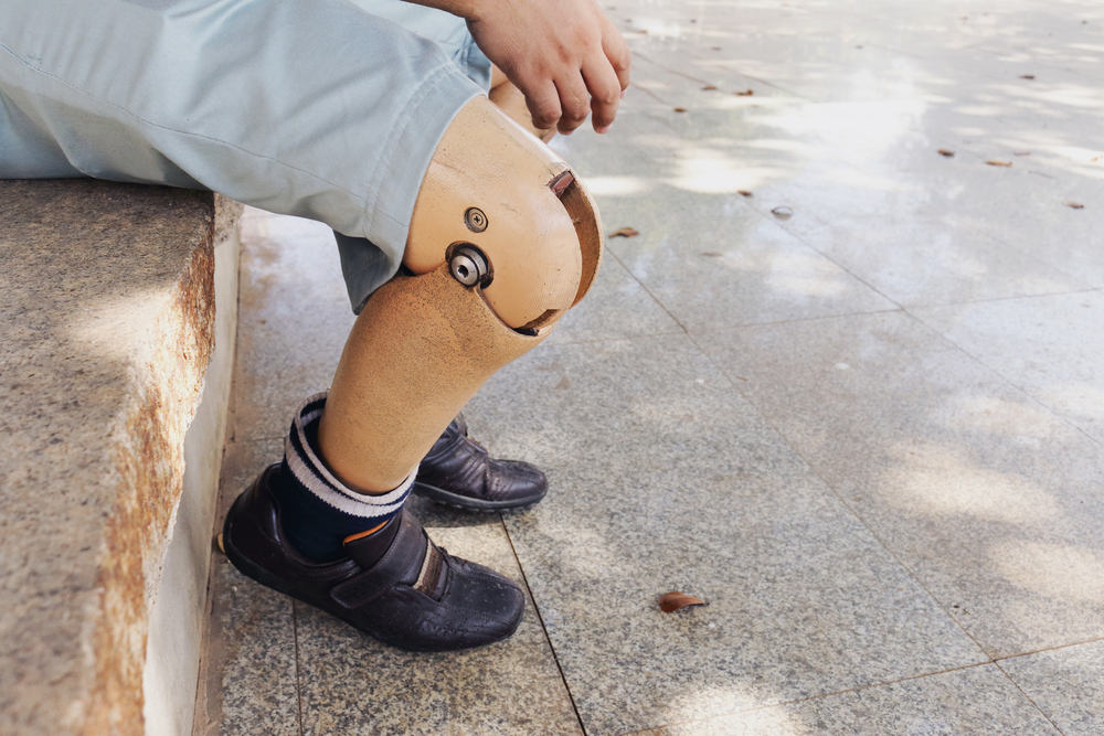 Advantages Of Using Plastic In Prosthetics